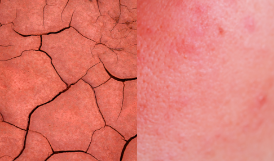 red inflamed patches on skin