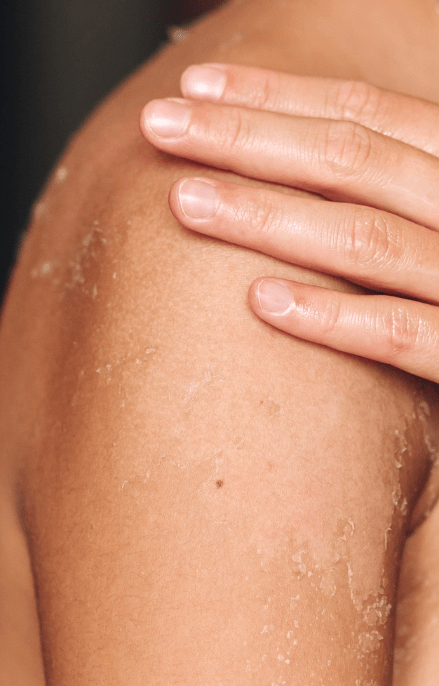 skincare for dry sensitive skin enlarged